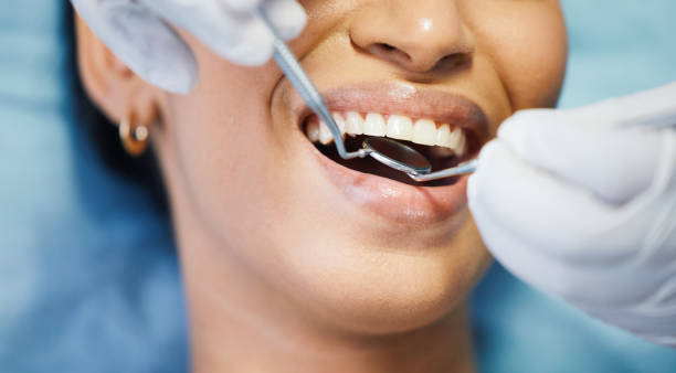 Best Emergency Dentist for Lost Fillings or Crowns in River Ridge, FL