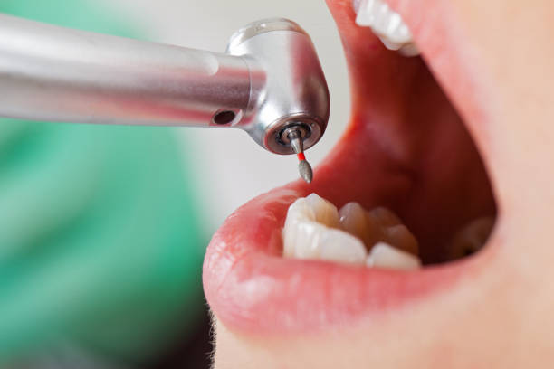 Best Orthodontic Emergency Dentist in River Ridge, FL
